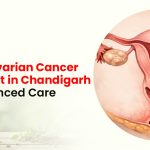 Expert Ovarian Cancer Specialist in Chandigarh for Advanced Care