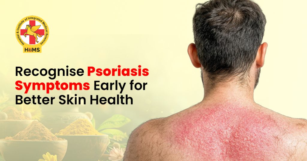 Psoriasis-Symptoms