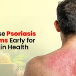 Recognise Psoriasis Symptoms Early for Better Skin Health