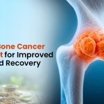 Effective Bone Cancer Treatment for Improved Health and Recovery