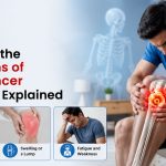What Are the Symptoms of Bone Cancer? Key Signs Explained