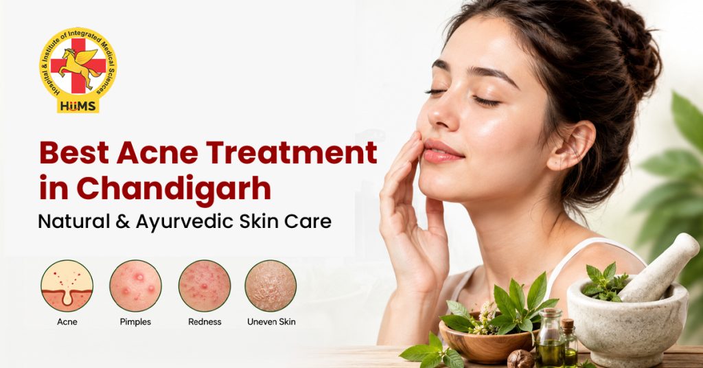 Best Acne Treatment in Chandigarh