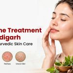 Best Acne Treatment in Chandigarh: Natural & Ayurvedic Skin Care
