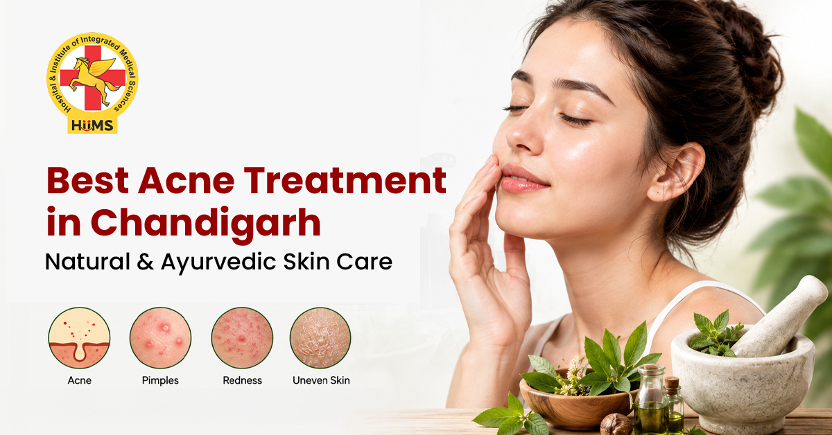 Best Acne Treatment in Chandigarh