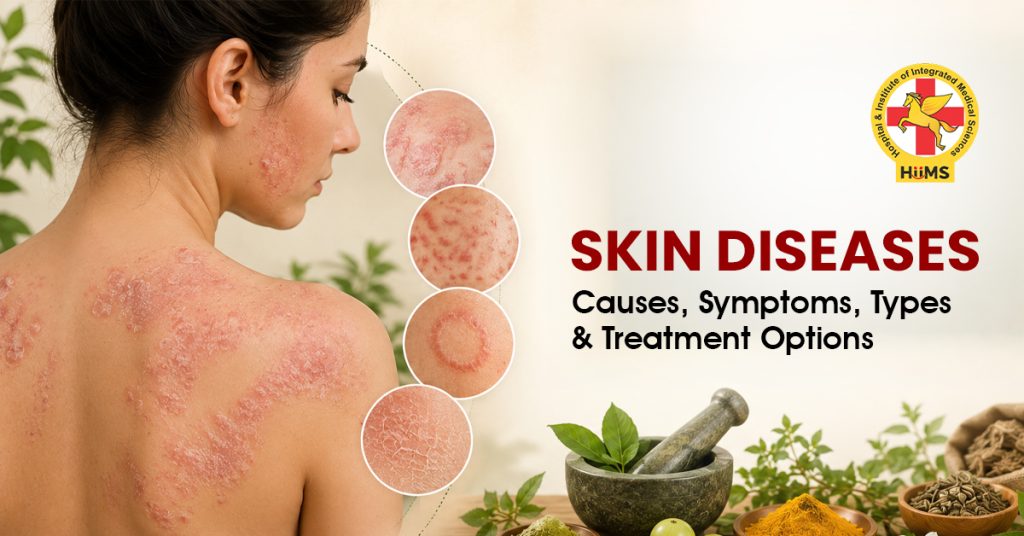 Skin Diseases