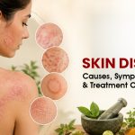 Skin Diseases: Causes, Symptoms, Types & Treatment Options