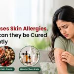 What causes skin allergies, and how can they be cured permanently