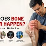 Why Does Bone Cancer Happen? Common Causes and Risk Factors