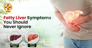 Fatty Liver Symptoms You Should Never Ignore