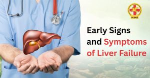 Early Signs and Symptoms of Liver Failure