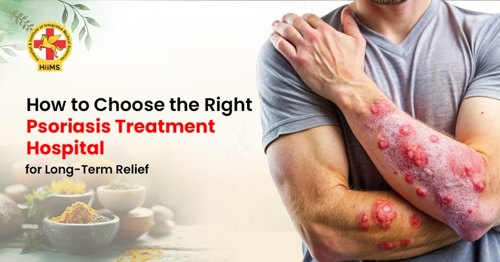 How to Choose the Right Psoriasis Treatment Hospital for Long-Term Relief