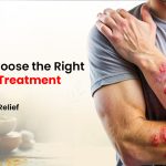 How to Choose the Right Psoriasis Treatment Hospital for Long-Term Relief