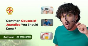 Common Causes of Jaundice You Should Know