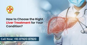 How to Choose the Right Liver Treatment for Your Condition