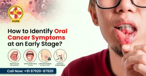 How to Identify Oral Cancer Symptoms at an Early Stage