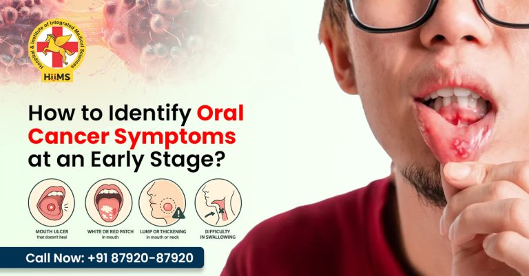 How to Identify Oral Cancer Symptoms at an Early Stage