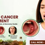 Mouth Cancer Treatment: Symptoms, Diagnosis, and Recovery Guide
