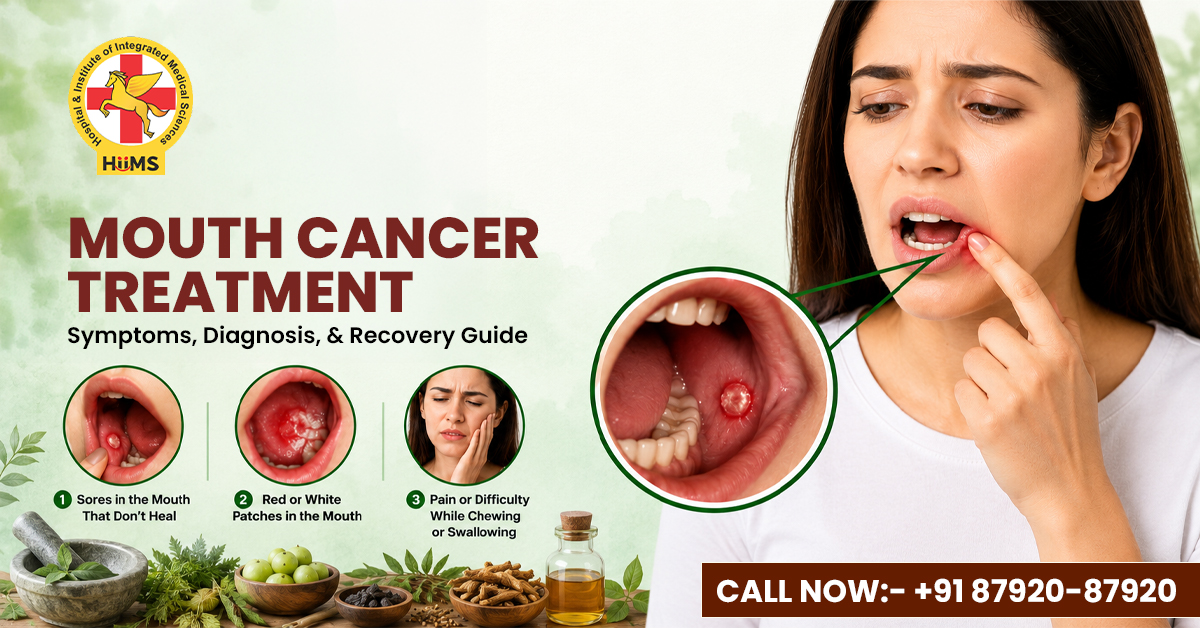 Mouth-Cancer-Treatment-Symptoms-Diagnosis-and-Recovery-Guide