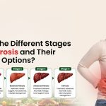 What Are the Different Stages of Liver Fibrosis and Their Treatment Options?