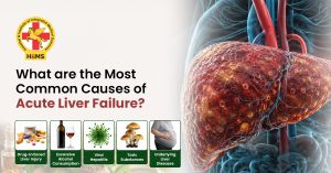 Most-Common-Causes-of-Acute-Liver-Failure