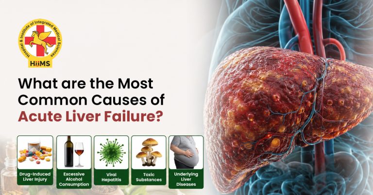 Most-Common-Causes-of-Acute-Liver-Failure