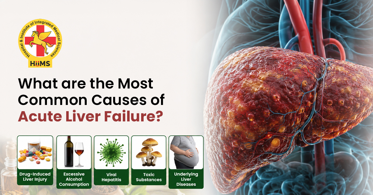 Most-Common-Causes-of-Acute-Liver-Failure