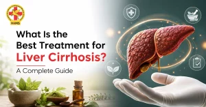 What-Is-the-Best-Treatment-for-Liver-Cirrhosis