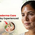 Leukoderma Care with advanced skin treatment solutions