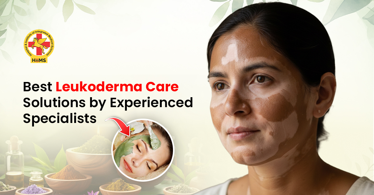 Leukoderma Care with advanced skin treatment solutions