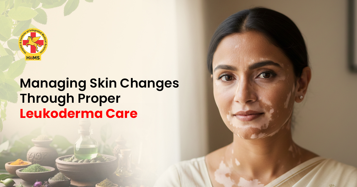 Leukoderma treatment and care for healthy skin