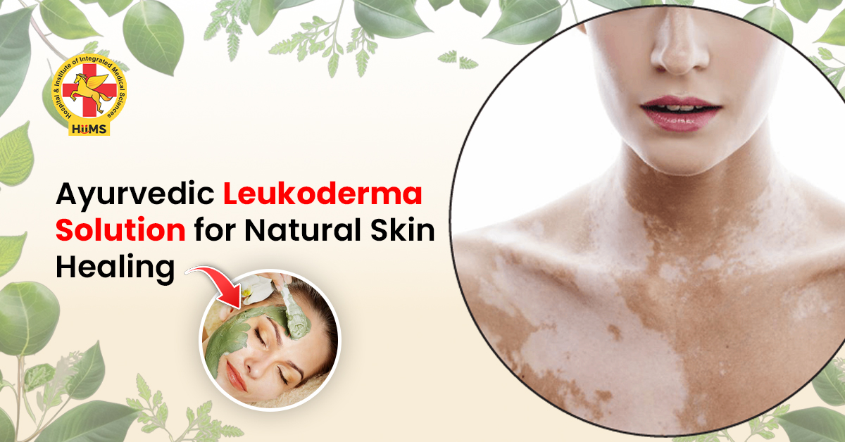 Leukoderma solution showing natural skin tone improvement