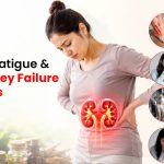 Swelling, Fatigue & Other Kidney Failure Symptoms