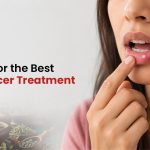 Looking for the Best Mouth Ulcer Treatment in Goa?