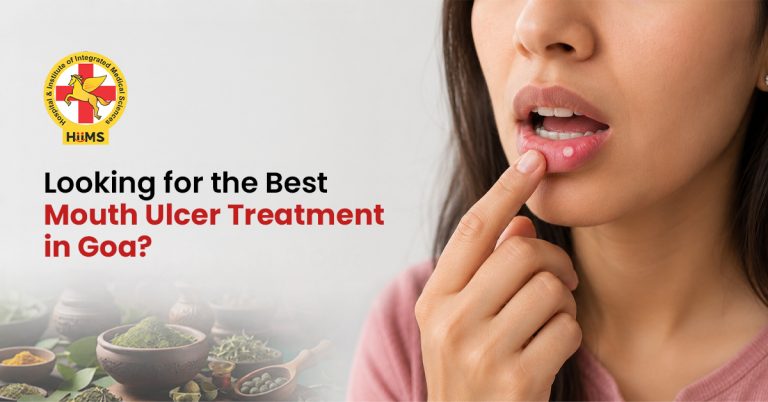 Mouth Ulcer Treatment in Goa