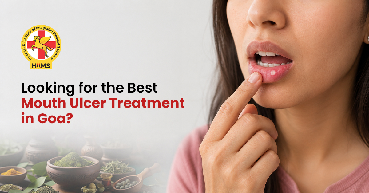 Mouth Ulcer Treatment in Goa