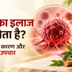 कैंसर का इलाज कैसे होता है? जानें लक्षण, कारण और आयुर्वेदिक उपचार