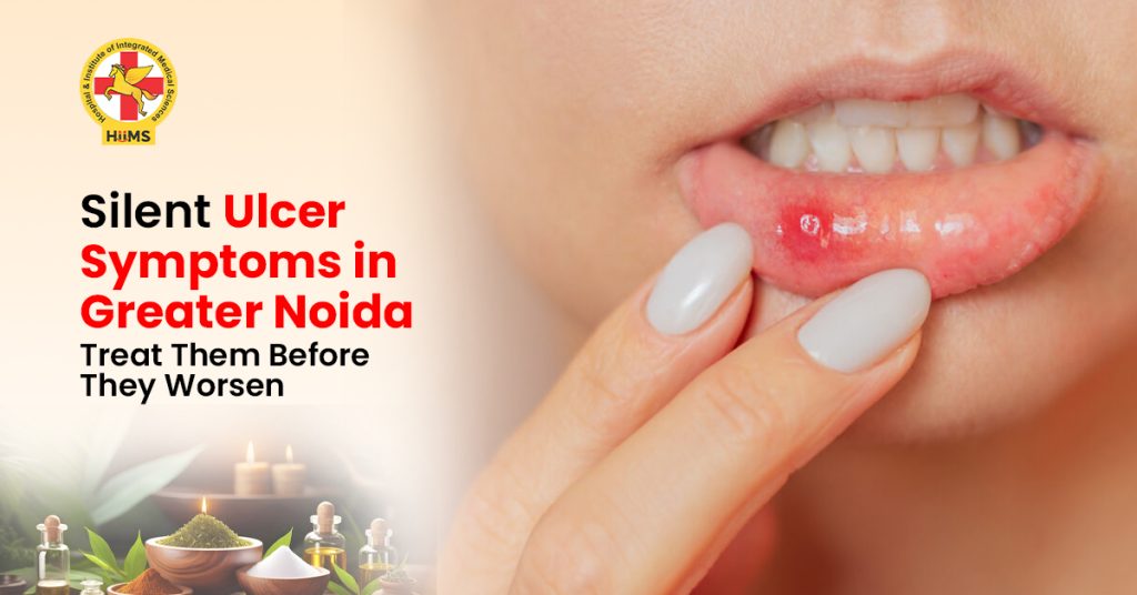 Silent Ulcer Symptoms in Greater Noida