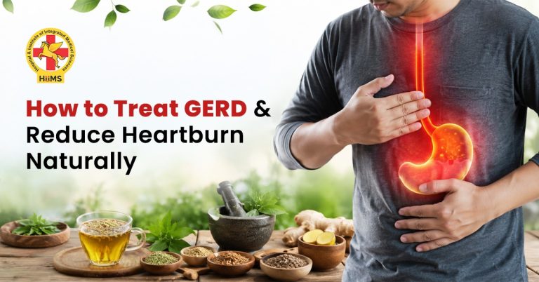 How to Treat GERD