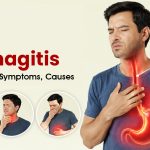 Esophagitis: Causes, Symptoms, and Natural Treatment