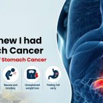 How I Knew I Had Stomach Cancer: 5 Early Signs of Stomach Cancer