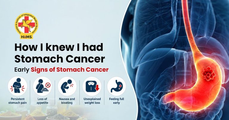 Signs-of-Stomach-Cancer