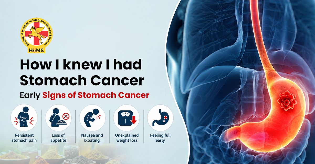 Signs-of-Stomach-Cancer