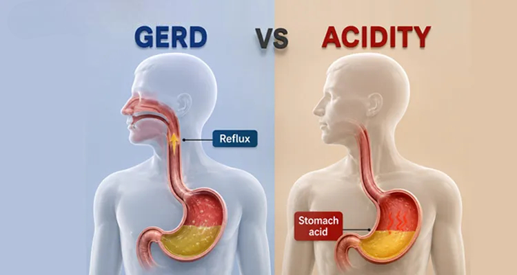 Acidity and GERD