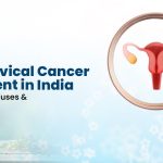 Best Cervical Cancer Treatment in India: Symptoms, Causes & Care Options