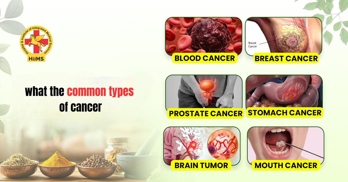 what the common types of cancer