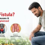 What is Fistula? Symptoms, Causes & Treatment Explained