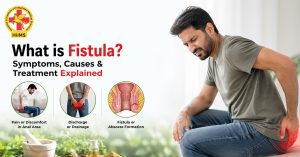 What is Fistula Symptoms, Causes & Treatment Explained