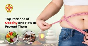 Causes of obesity including unhealthy diet and inactive lifestyle