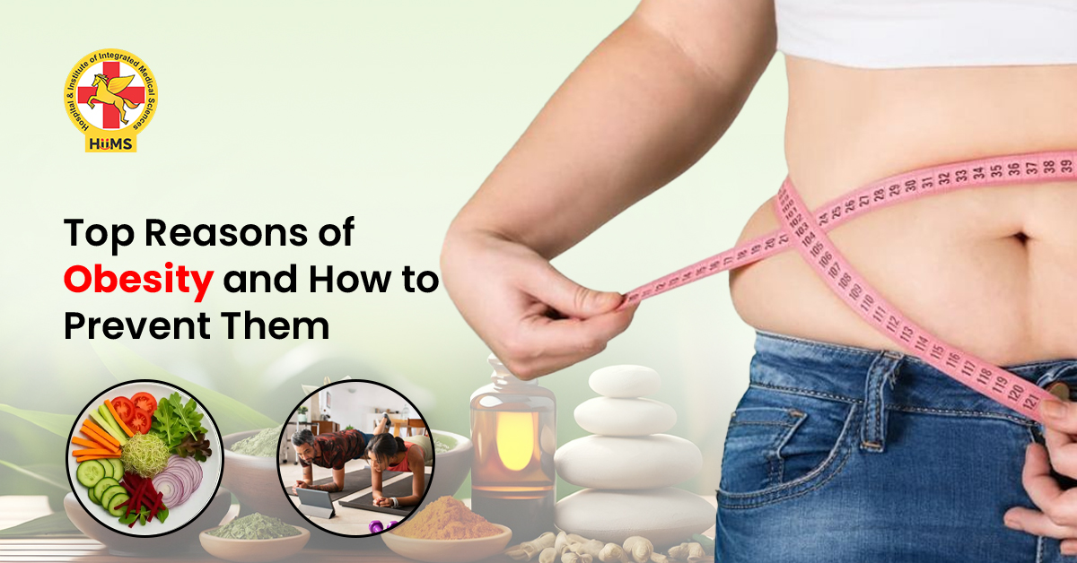 Causes of obesity including unhealthy diet and inactive lifestyle