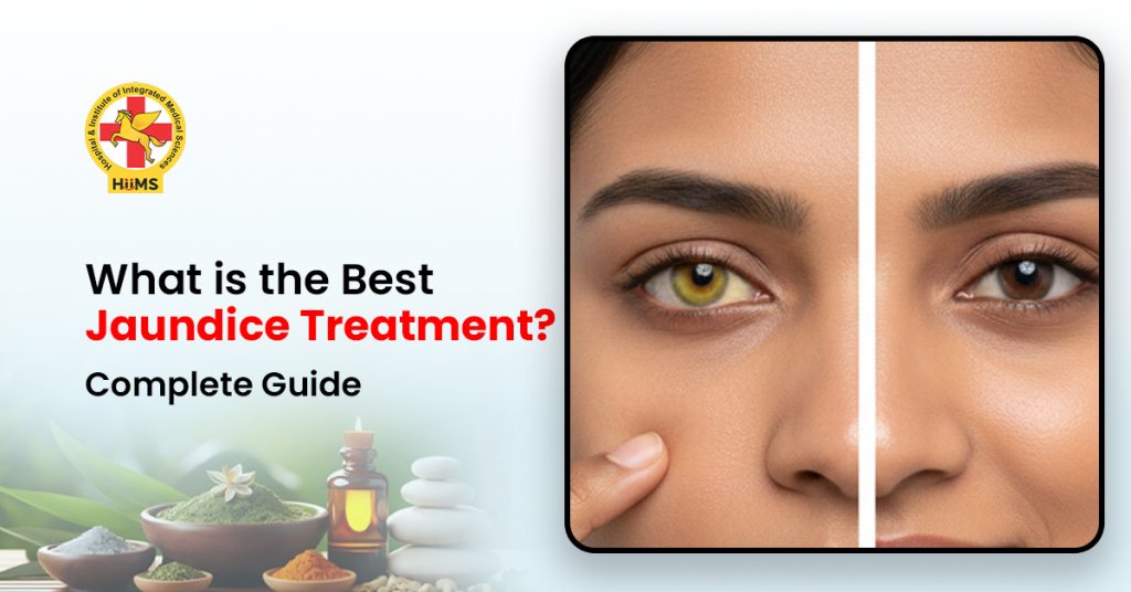 Jaundice treatment through Ayurveda at Jeena Sikho HiiMs